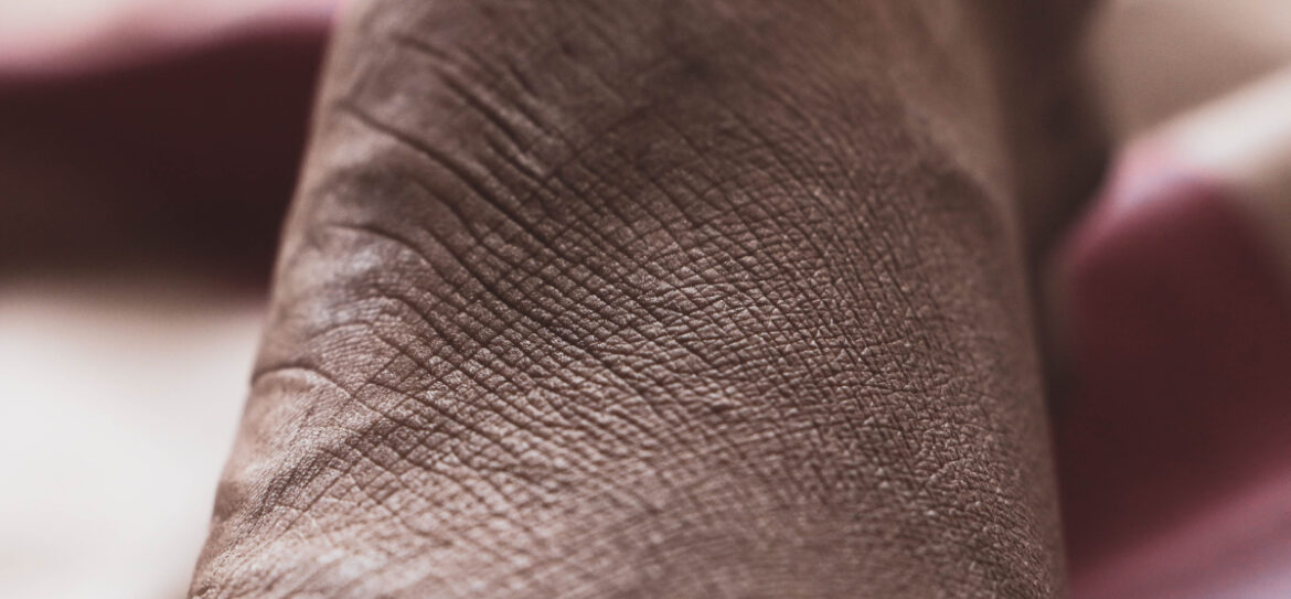 visible signs of aging