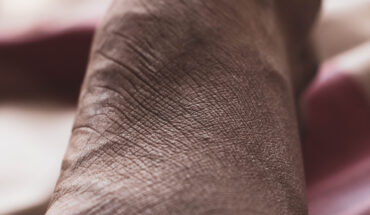 visible signs of aging